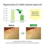 [Dr.Althea] Gentle Vitamin C Serum (30mL/1.01fl.oz)