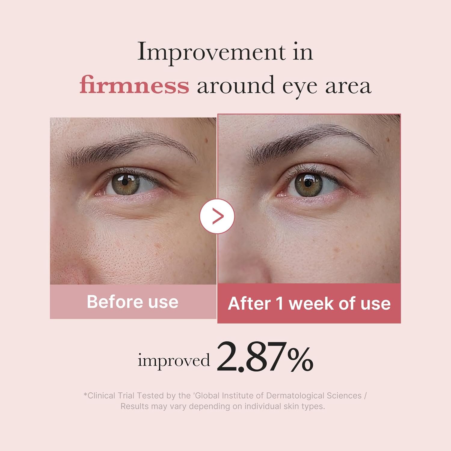 Medicube PDRN Pink Peptide Eye Cream (30ml / 1.01 fl. oz.) | K-Beauty Salmon DNA & 99% Pure Retinol Dark Circle Eye Cream