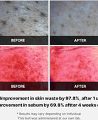Medicube Red Succinic Acid Panthenol Pads (70 Pads) | Acne Clearing Toner Pads for Breakouts, Pores & Post-Acne Marks